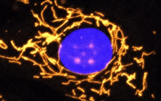 Healthy Cell Shows Mitochondrial Network